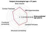 Multimodality MRI brain age prediction