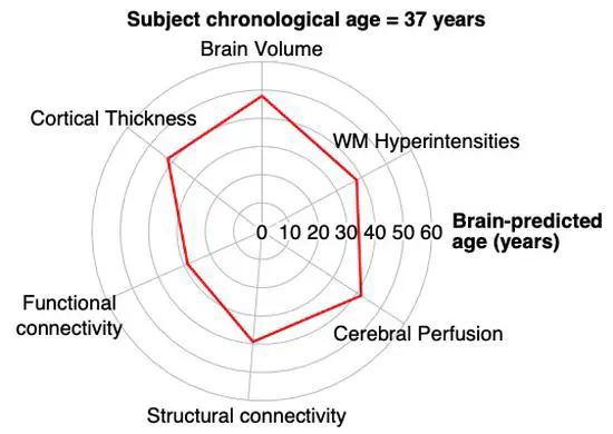 Multimodality MRI brain age prediction